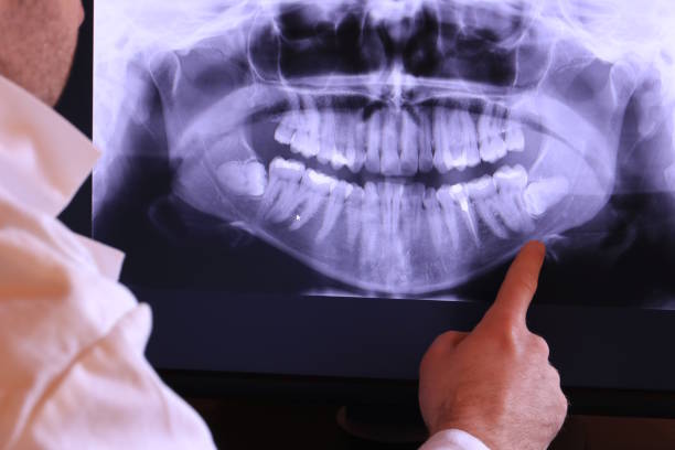 Best Pediatric Emergency Dentist in Buckhead, GA