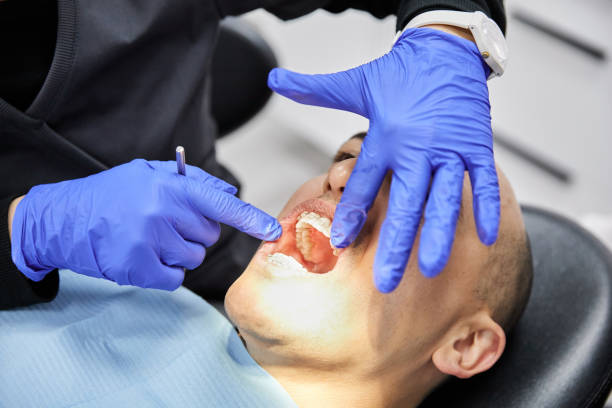 Best Emergency Dental Services for Seniors in Buckhead, GA